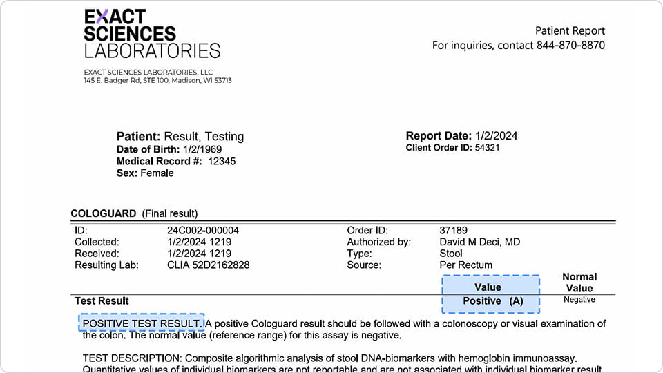 A sample of a positive Cologuard test report.